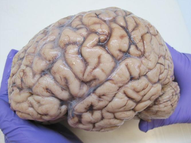 Cervello (anatomia umana)