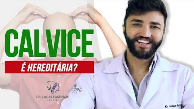 Video Calvice É HEREDITÁRIA: Será que vou ficar Careca? | Dr  Lucas Fustinoni en français