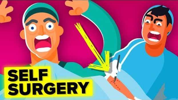 Video Why A Doctor Removed His Own Appendix su italiano