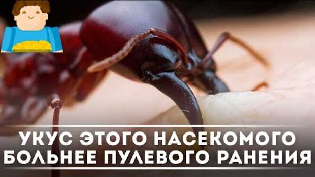 Video Укус этого насекомого БОЛЬНЕЕ пулевого ранения [Plushkin] na Polish