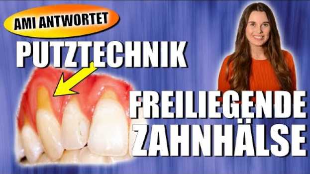 Video Freiliegende Zahnhälse und keilförmige Defekte - Putztechnik | DoctorAmi in English