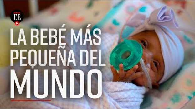 Video La bebé más pequeña del mundo nace en EEUU: pesó lo mismo que una manzana | El Espectador em Portuguese