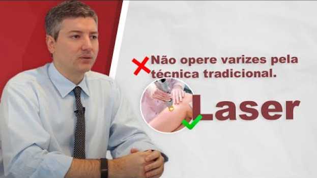 Video Cirurgia de varizes: Laser? Tradicional? O que fazer? in English