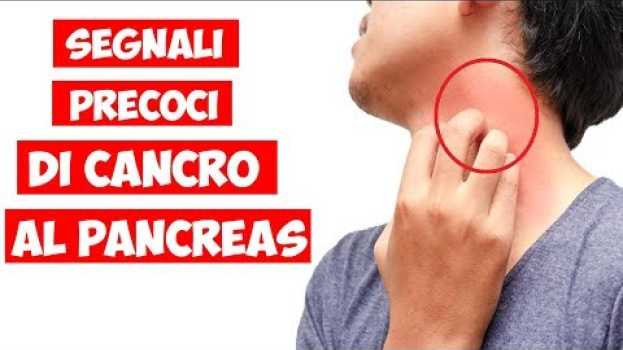 Видео 9 Segni Premonitori del Cancro al Pancreas che Devi Sapere! на русском