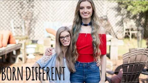 Видео My Identical Twin With Dwarfism | BORN DIFFERENT на русском