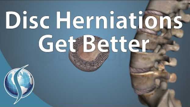 Video Can a Disc Herniation Heal Itself? in English
