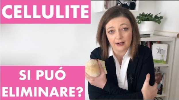 Video Cellulite: si può eliminare? em Portuguese