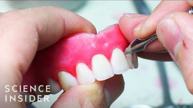 Video How Dentures Are Made | The Making Of in Deutsch