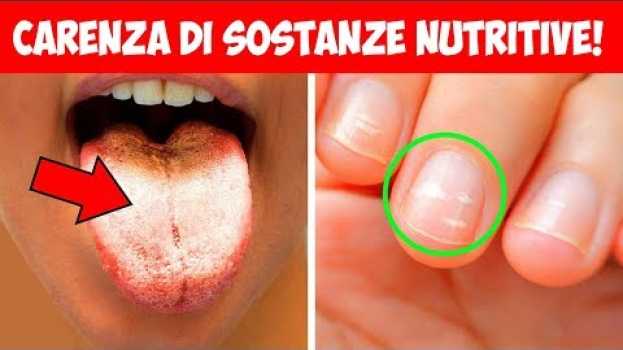 Video I 9 segni di carenza di sostanze nutritive che non devono essere ignorati su italiano