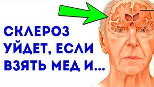 Видео Уникальное древнее средство от рассеянного склероза / Чтобы не получить склероз, рекомендуется... на русском