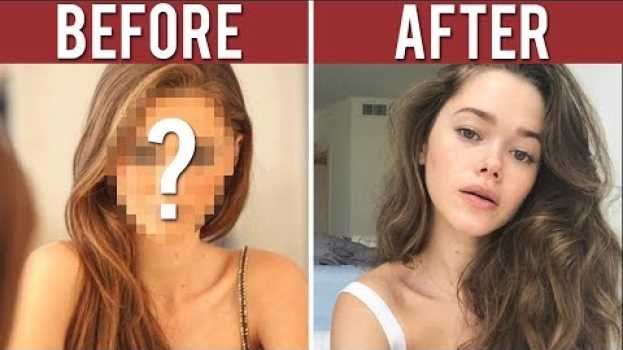 Video Why I Had A Nose Job At 16 in Deutsch
