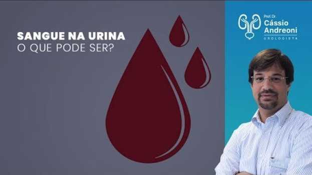 Видео Sangue na urina, o que pode ser? | Dr. Cassio Andreoni CRM 78.546 на русском