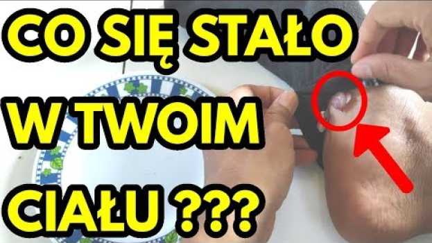 Video Jeśli codziennie kładziesz cebulę na stopach, co stanie się z twoim ciałem ? in Deutsch