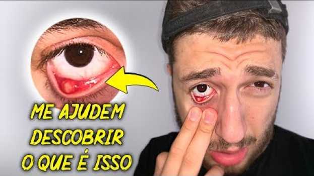 Video ISSO SURGIU DENTRO DO MEU OLHO DO NADA!!! in English