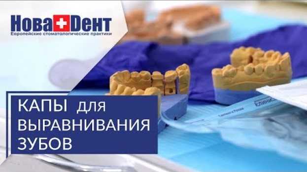 Video Капы для зубов. 🌞 Исправление прикуса с помощью капы для зубов. НоваДент. 12+ na Polish