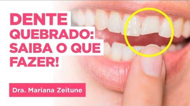 Video DENTE QUEBRADO Tem Solução! Dentista explica o que fazer se você quebrou o dente en français