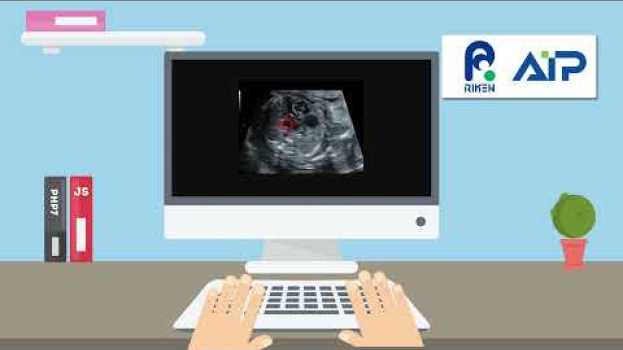 Video Explanatory artificial intelligence improves the diagnosis of congenital heart defects before birth in English