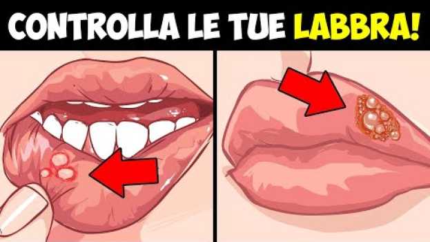 Video 9 segnali di avvertimento per la salute da parte delle tue labbra in Deutsch