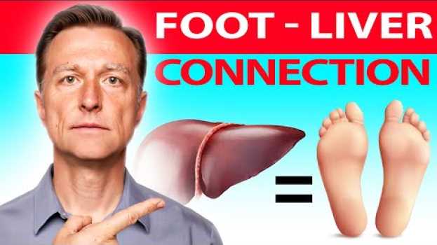 Video How Your Feet Can Reveal Liver Problems and What You Can Do About It - Dr. Berg's Expert Tips na Polish