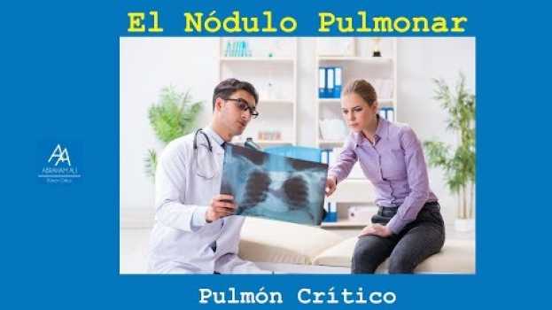 Video Nódulo Pulmonar no siempre es igual a Cáncer em Portuguese