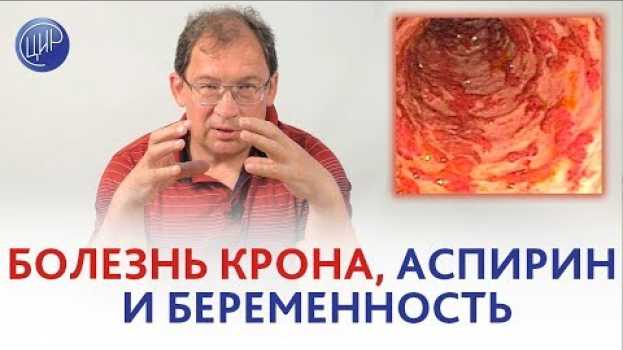 Видео БОЛЕЗНЬ КРОНА, аспирин и беременность. МОЖНО ЛИ пить АСПИРИН при болезни Крона? на русском