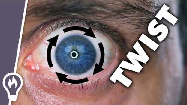 Video I Can Twist My Eye Around Its Pupil (And So Can You) in English
