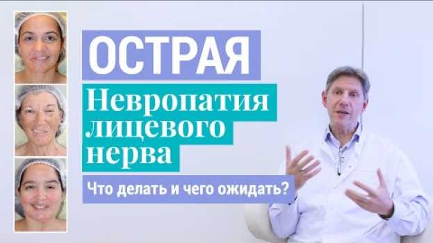 Видео Паралич Белла: Что делать и чего ожидать при острой невропатии (неврите) лицевого нерва на русском