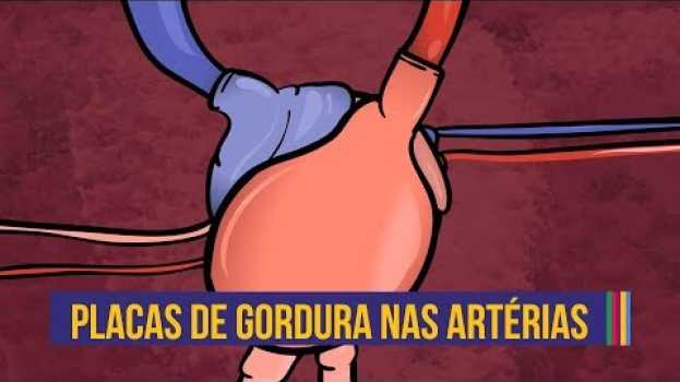 Video Como se formam as placas de gordura | Animação #08 en Español