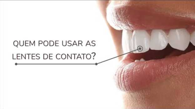 Video Você já ouviu falar de lentes de contato dental? | Dra. Nanda Menezes su italiano