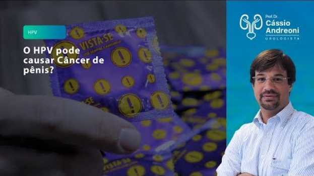 Video O HPV pode causar Câncer de Pênis? | Dr. Cassio Andreoni CRM 78.546 en Español