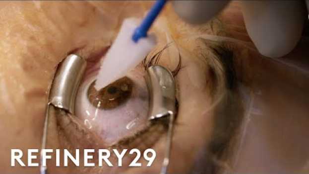 Видео What Getting Laser Eye Surgery Is Really Like | Macro Beauty | Refinery29 на русском