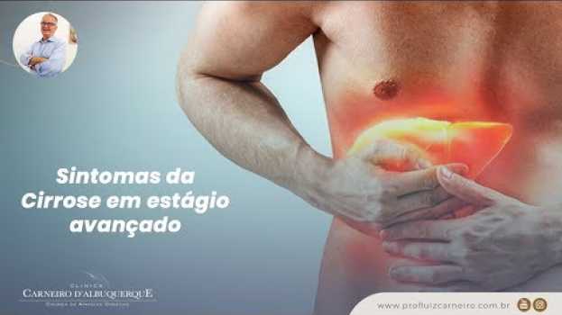 Video Sintomas da Cirrose em estágio avançado | Prof. Dr. Luiz Carneiro CRM 22761 en Español