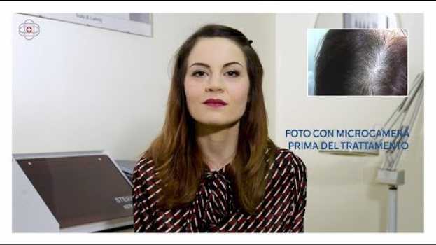 Video Diradamento e caduta capelli donna: i risultati dopo la cura en Español