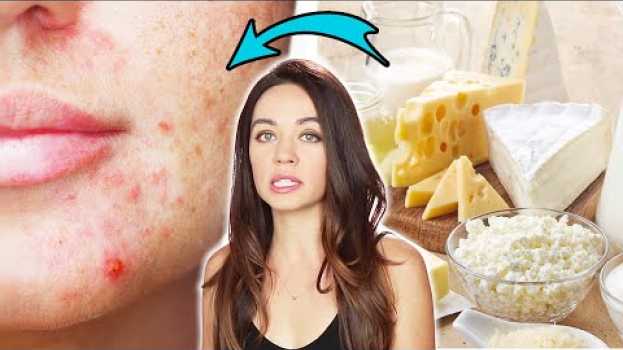 Video Nutritionists Reveal Which Foods Affect Your Acne em Portuguese