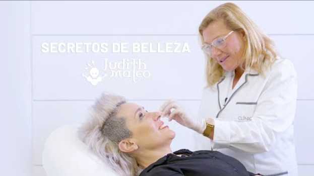 Video Tratamiento Facial de Judith Mateo - Relleno de 3 zonas [Antes y Después] na Polish