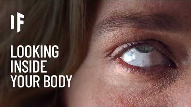 Video What If We Could Look Inside Our Bodies? en français