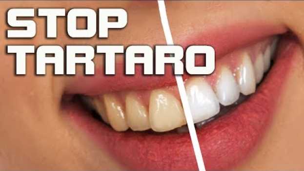 Video Togliere il tartaro dai denti, rimedi naturali per la pulizia dei denti na Polish