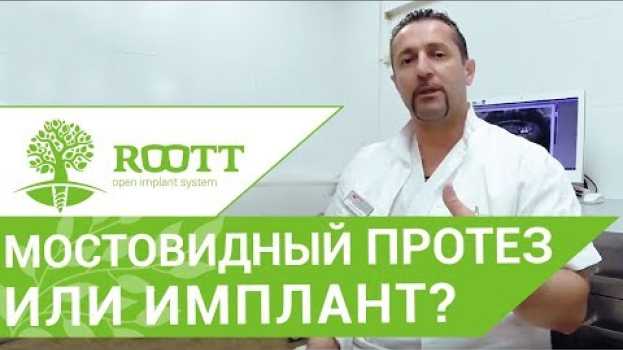 Video Имплант или мостовидный протез. 🤔 Что выбрать мостовидный протез или имплант? in English