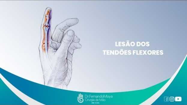 Видео Lesão dos tendões flexores | Dr. Fernando Moya CRM 112.046 на русском