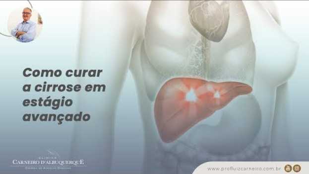 Video Como curar a cirrose em estágio avançado | Prof. Dr. Luiz Carneiro CRM 22761 in Deutsch