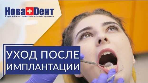 Video 🔴 Важные рекомендации после имплантации зубов. Рекомендации после имплантации. НоваДент. 12+ na Polish