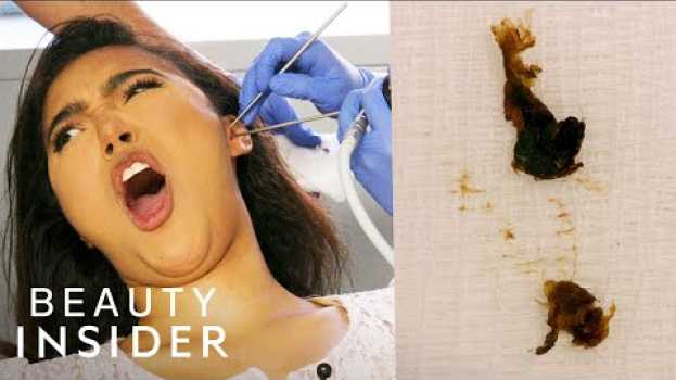Video How Earwax Is Professionally Extracted | Beauty Explorers | Insider Beauty na Polish
