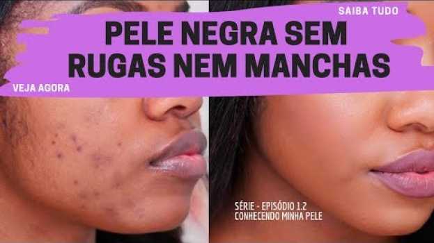 Video SÉRIE 1.2 - PELE NEGRA SEM RUGAS NEM MANCHAS - Conheça sua pele em Portuguese