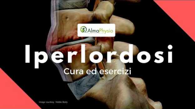 Video iperlordosi cura ed esercizi en Español