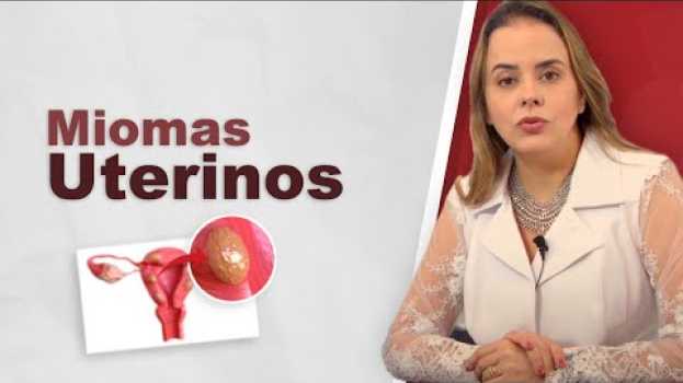 Video Miomas uterinos. Leiomiomas no útero. Mal muito frequente. en Español