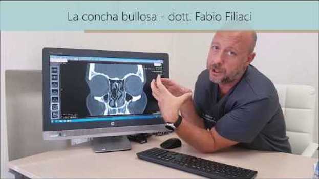 Video Conca bullosa (più correttamente Concha bullosa); cos’è e cosa comporta? em Portuguese