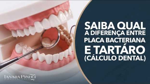 Video Saiba Qual a Diferença entre Placa Bacteriana e Tártaro (Cálculo Dental) | Ianara Pinho su italiano