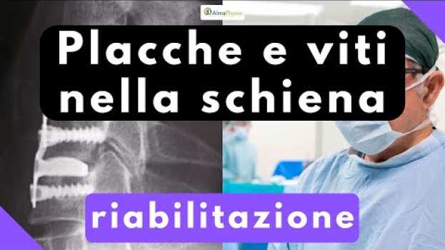 Video Placche e viti nella schiena: riabilitazione in Deutsch