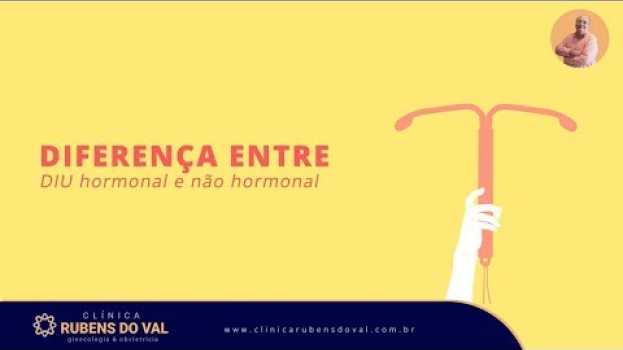 Video Diferença entre DIU hormonal e não hormonal | Dr. Rubens do Val CRM 58764 en français