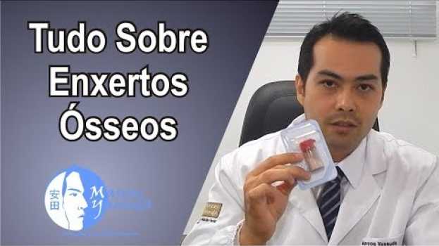 Video Tudo sobre exertos ósseos, Conheça os tipos de enxertos e suas aplicações en Español